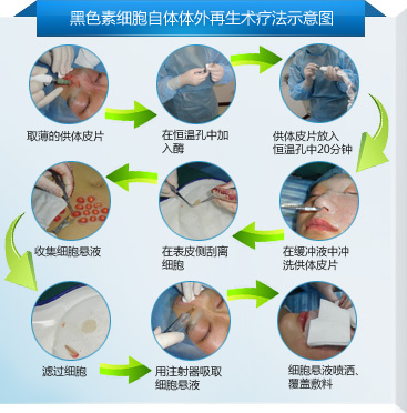 ��ɫ��ϸ�����������������Ʒ�ͼ