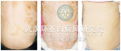 ���ȱ�������Ļ���