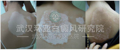 �ָ������������ӻ��ǿ�ʼ