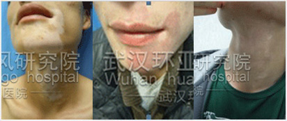 �����ɱ� ���������ػ�������