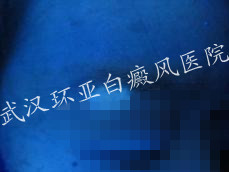 �κð��� ���ʣŮ����